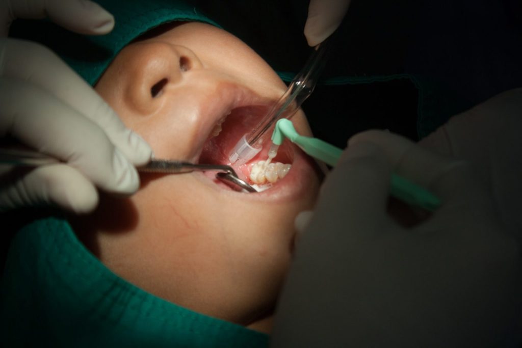 Still Life-Dentists using the tool dental children, sealant.